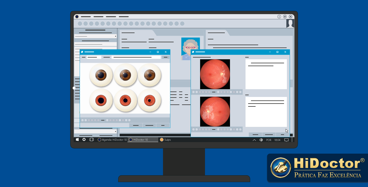 As vantagens de utilizar um software médico próprio para oftalmologia